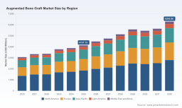 PW Consulting: Worldwide Augmented Bone Graft Market to Climb from USD 4.14B in 2025 to USD 6.30B by 2032 at 6.18% CAGR &mdash; North America, Synthetic Grafts and Spinal Fusion Lead (CR3: 48.6%)