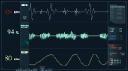 Electrocardiograph (ECG) Market development driven by digitization in point-of-care diagnostic tools