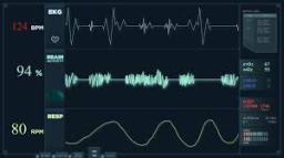 Electrocardiograph (ECG) Market development driven by digitization in point-of-care diagnostic tools