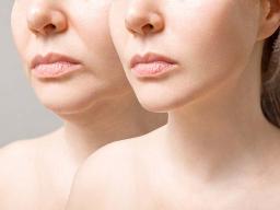 What Are the Mental Health Benefits of Cosmetic Surgery?