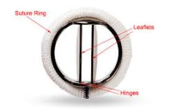 Prosthetic Heart Valves Market Share Breakdown