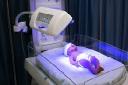 Phototherapy Lamps Market Innovations