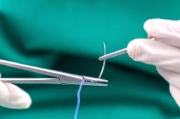 Surgical Sutures Market Emerging Trends Shaping Innovation, Adoption, and Future Growth Worldwide