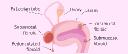 Uterine Fibroid Treatment Market Growth Challenges: Factors Limiting Expansion and Access to Therapies