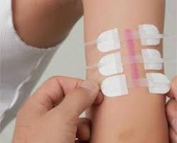 Non-invasive Surgical Wound Closure Market Revenue Growth Trends Forecast And Market Share