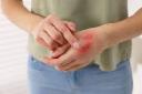 Advanced Wound Care Market Expanding Rapidly Through Innovation and Comprehensive Healthcare Solutions Globally