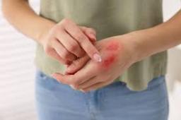Advanced Wound Care Market Expanding Rapidly Through Innovation and Comprehensive Healthcare Solutions Globally
