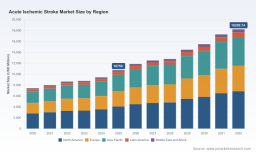 PW Consulting Forecast: Worldwide Acute Ischemic Stroke Market Set to Surge at a 7.82% CAGR Through 2032