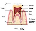 affordable root canal king albert park