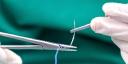Surgical Suture Market: Advancements in Wound Closure and Surgical Technologies