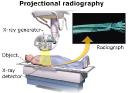 X-ray Detectors Market: Advancing the Future of High-Precision Digital Imaging