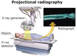 X-ray Detectors Market: Advancing the Future of High-Precision Digital Imaging