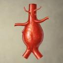 Aortic Aneurysm Market: Advancing Diagnosis and Life-Saving Treatment Solutions