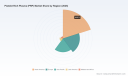 PRP Market Analysis: How 10.5% CAGR to $1B Reshapes Orthopedics and Aesthetics