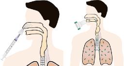 Global Intranasal Vaccine is projected to reach US$948 million by 2033