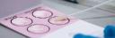 Specimen Collection Cards Market Key Success Factors in Expanding Access to Efficient Diagnostic Solutions