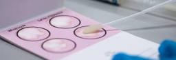 Specimen Collection Cards Market Key Success Factors in Expanding Access to Efficient Diagnostic Solutions