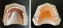 Orthopedic Braces & Supports Market Research Highlights Key Challenges and Opportunities