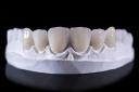 Dental Ceramic Market analysis of raw material availability and sustainability challenges
