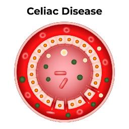 Autologous Cell Therapy Market Facing Global Barriers to Scalable Clinical Adoption