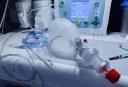 Automated CPR Devices Market Summary Shows Strong Potential for Emergency Medical Growth