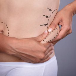 @lipoabdominoplasty