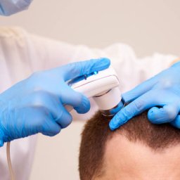 @hairtransplant